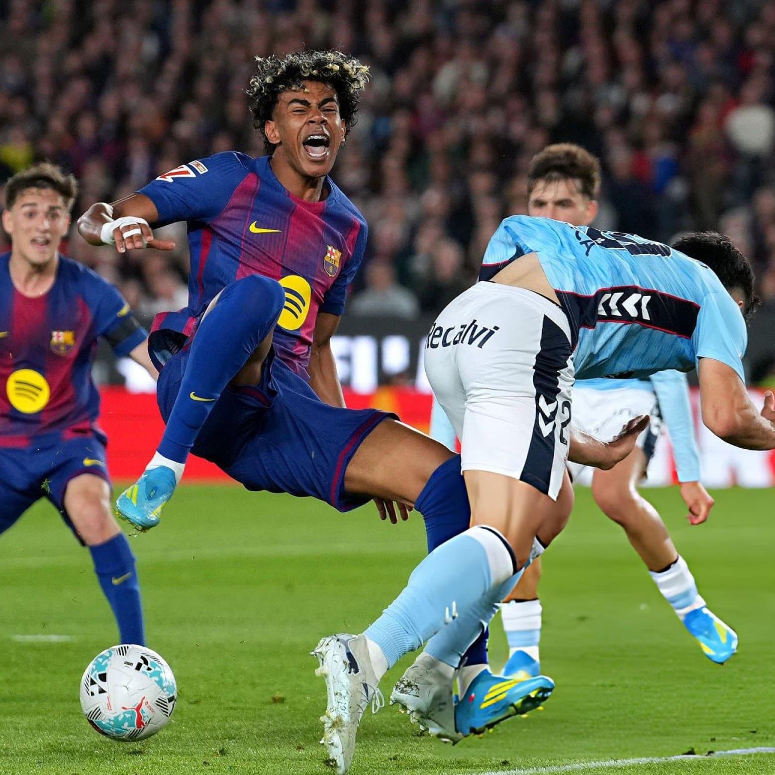 Lamine Yamal Injury Scare Rocks FC Barcelona and Spain